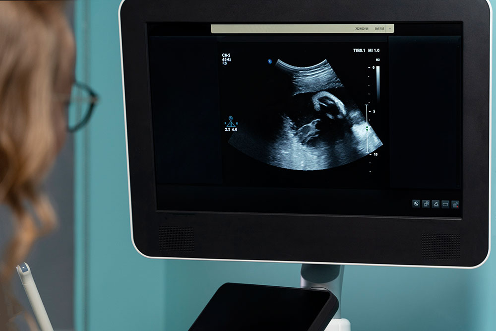 Ultrasound Services